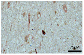 immunolocalization using anti ASyO2 antibodies